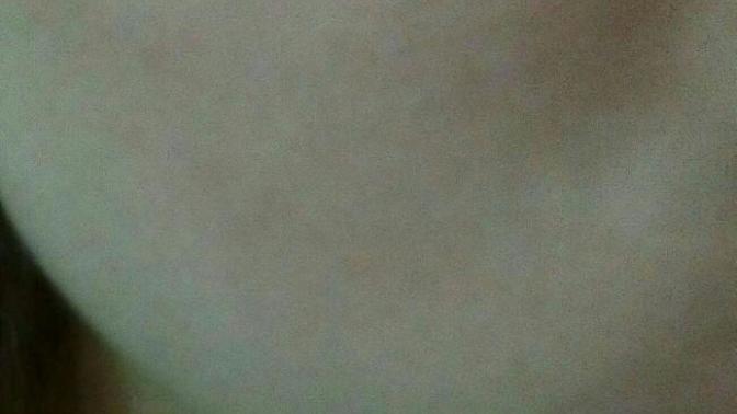 Goz altı yanakta yani olan gamzenin adı ne sizce guzel duruyor mu?