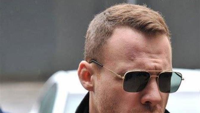 Kerem Bursin gibi saç ön çizgisi nasıl duruyor kötü mü?