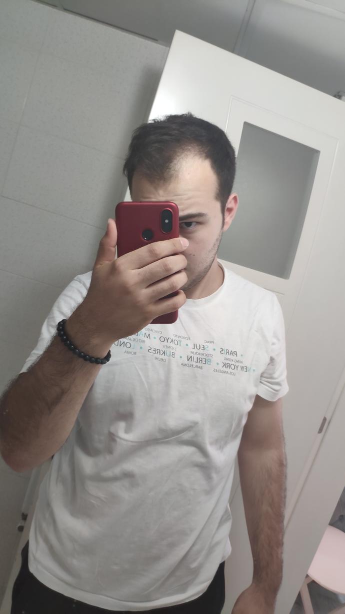 Kızlar, Bana kısa saç gider mi (SS'li)?