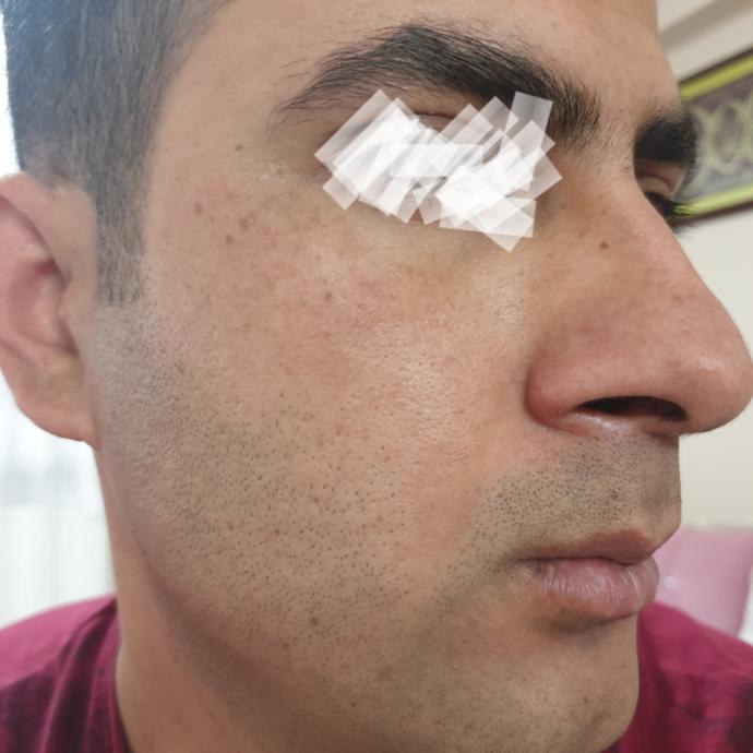 Guzellik uzmani  ya da  ciltten anyalan  var mı  ya yuz cildim beni cok etkilio akil vercek dalgaya alacak ywzmasin zaten psikoljm bok?