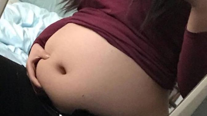 Pcos ve insülin direncim var göbeğim çok büyüdü nasıl kilo verebilirim?
