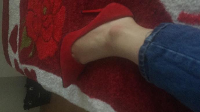 Topuklu ayakkabı bşr numara sıkıyor önden, bisey olur mu?