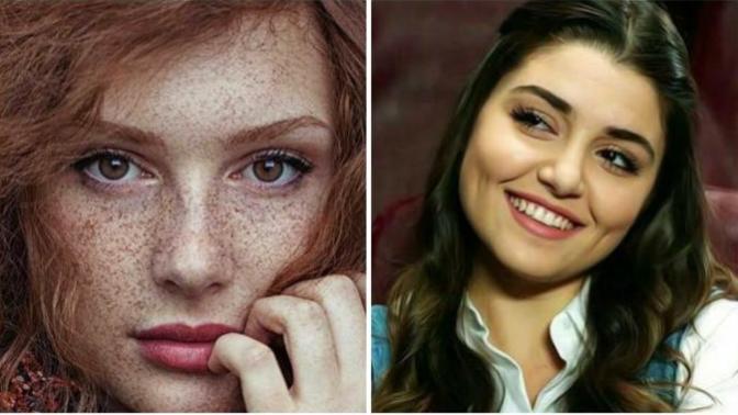 Çilli olmak mı, gamzeli olmak mı? Sizce hangisi insanı daha çekici gösterir?