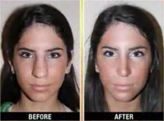 Jen Selter'in estetiksiz halini görmüş müydünüz?