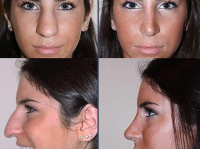 Jen Selter'in estetiksiz halini görmüş müydünüz?