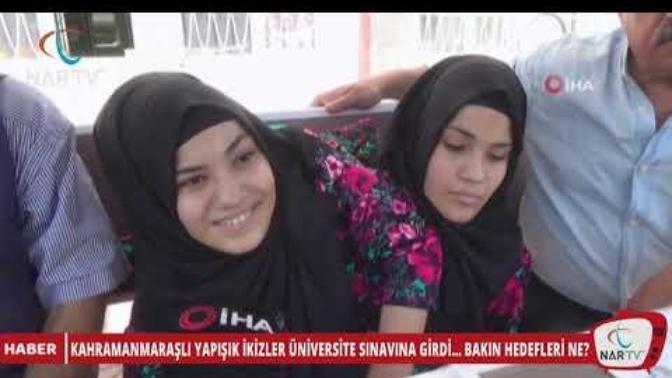 Yapışık İkizler Hakkında Önemli Sorular :D?