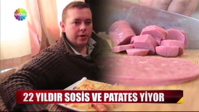 22 Yıl boyunca sosis ve patates yiyor. Peki ya 22 yıl boyunca siz ne yemek isterdiniz?