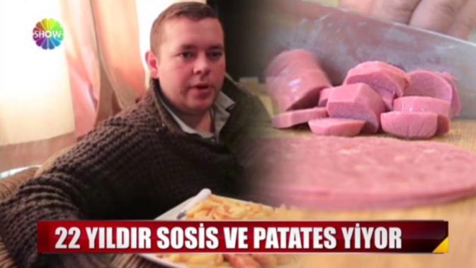 22 Yıl boyunca sosis ve patates yiyor. Peki ya 22 yıl boyunca siz ne yemek isterdiniz?