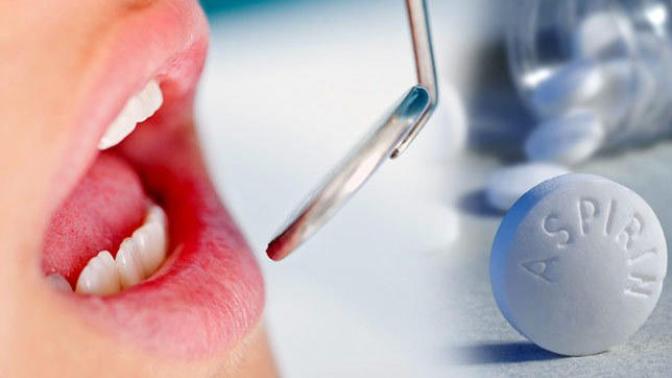 Araştırmalar aspirinin çürük dişleri tedavi ettiğini ortaya çıkardı! Ne söylemek istersiniz?