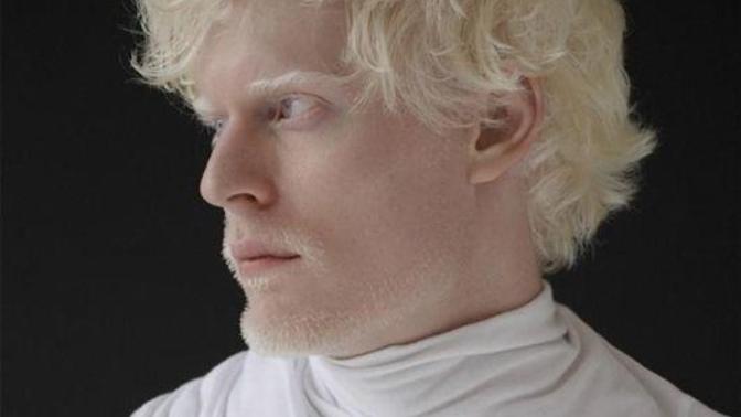 Zenci erkek mi albino erkek mi?
