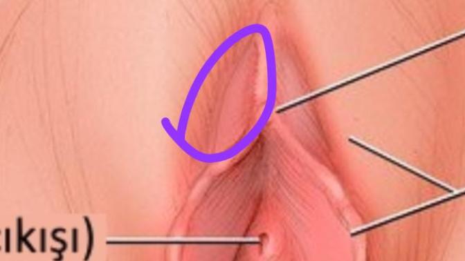 Genital bölgemde ki şişlik neden olabilri doktora gitmeli miyim?