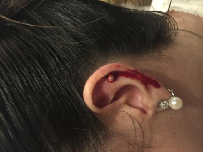 Piercingim çok kanıyor ne yapmalıyım?