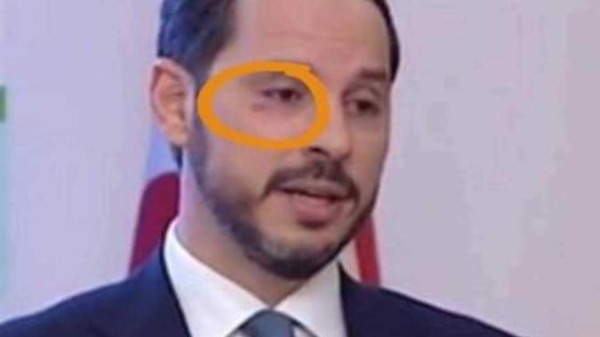 Akp'li Hazine ve Ekonomi Bakanı Berat Albayrak'ı fena benzetmemişler mi?