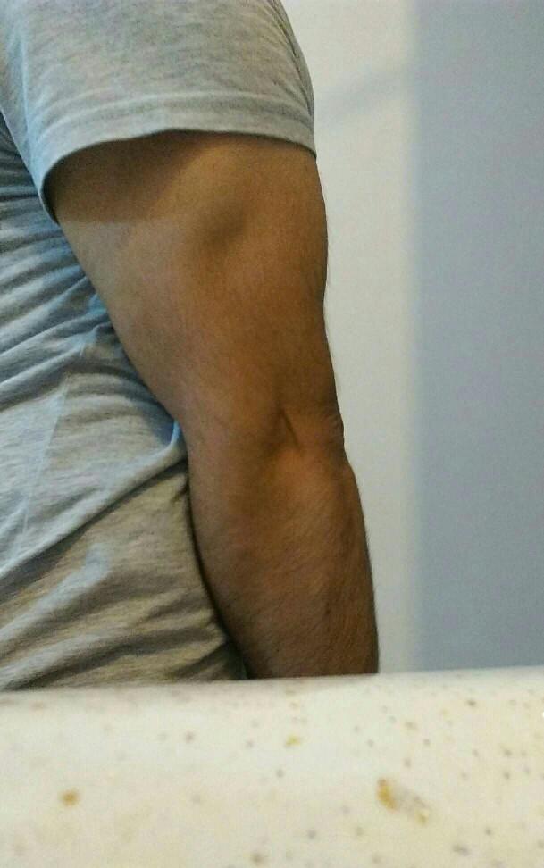 Biceps mi yoksa Triceps mi??
