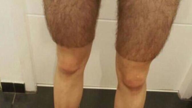 Şort giyen erkek bacak tüylerini almalı mı?
