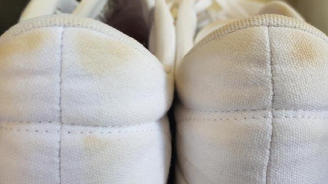 Beyaz bez ayakkabıdaki sarı lekeler nasıl çıkar?