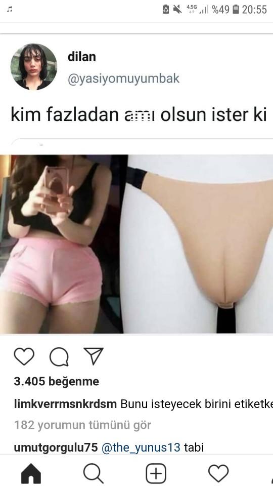 Takma organ hakkında ne düşünüyorsunuz?