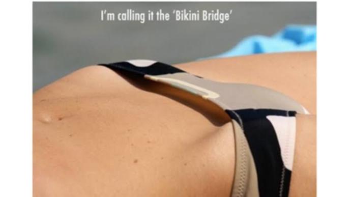 Bikini giydiginizde bu goruntuyu seviyo musunuz? Bikini bridge diyorlar?