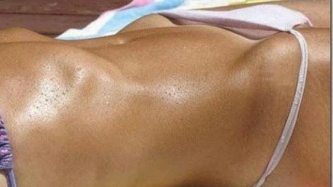 Bikini giydiginizde bu goruntuyu seviyo musunuz? Bikini bridge diyorlar?