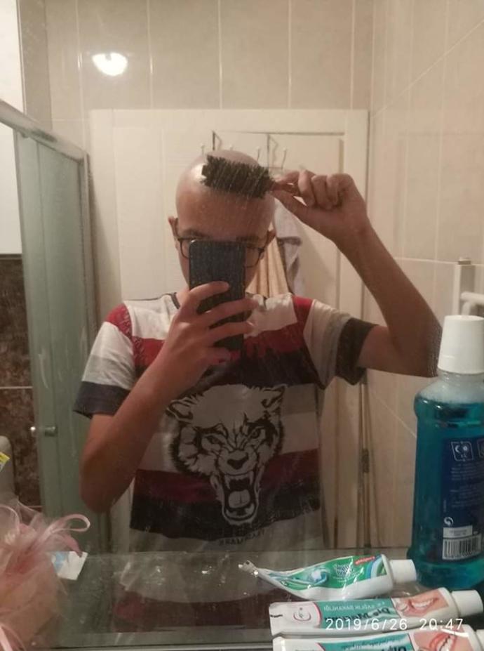 Saçımı kazidim 😂 ? var mı Şu an kel olanlar?