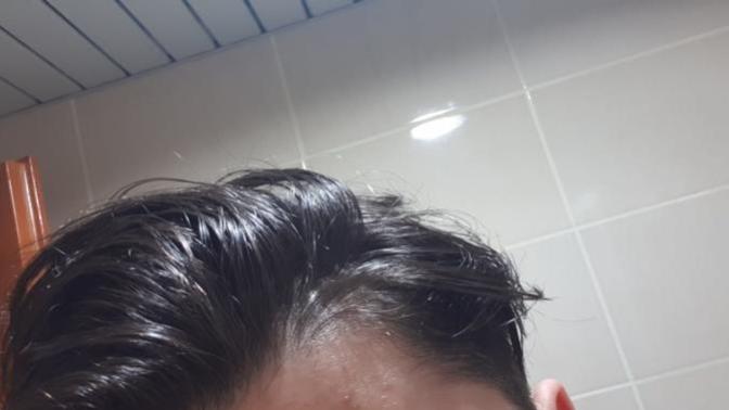 Saçlarım dökülüyor mu?