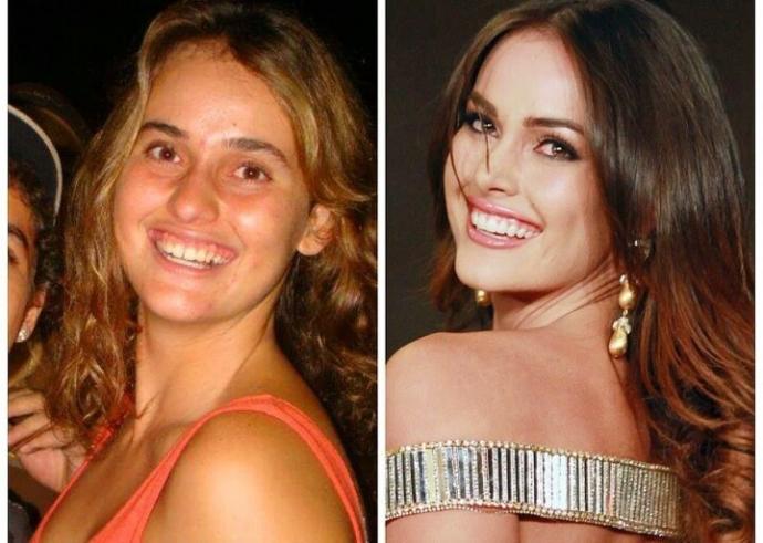 "Estetik bir insanı bu kadar mı değiştirir" dediğiniz ünlü kim?