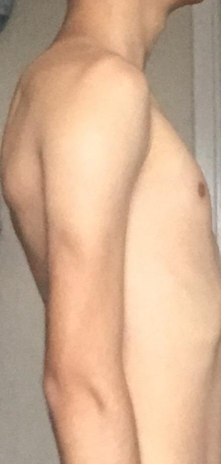Kambur Muyum? Değil Miyim?