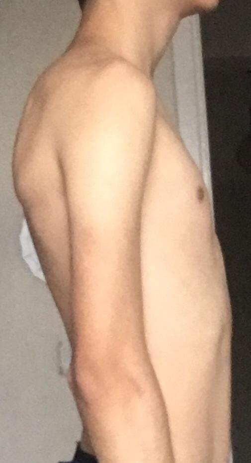 Kambur Muyum? Değil Miyim?