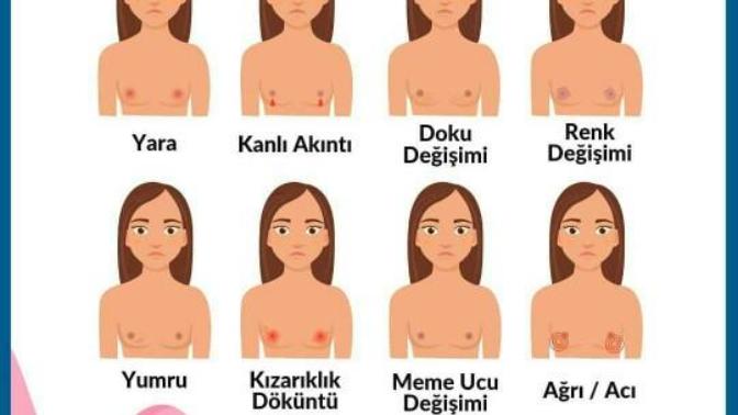 Meme Kanseri Belirtileri Nelerdir?