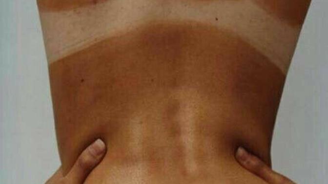 Bikini/mayo izi olmalı mı olmamalı mı?
