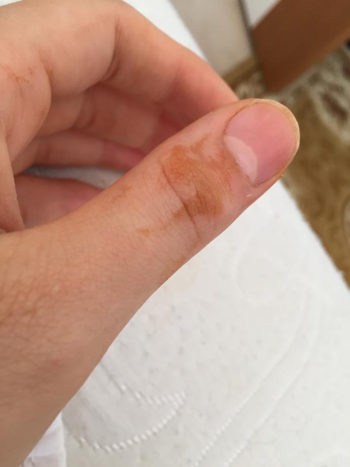 Parmağım da kınayla uyandım bu ne demek?