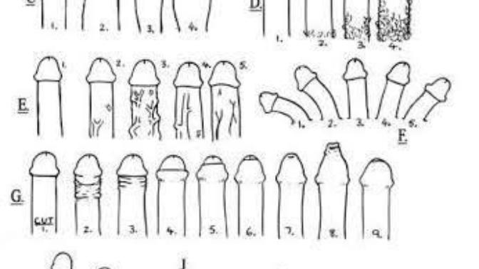 Kadınların erkeklerde görmek istediği penis tipi nedir?