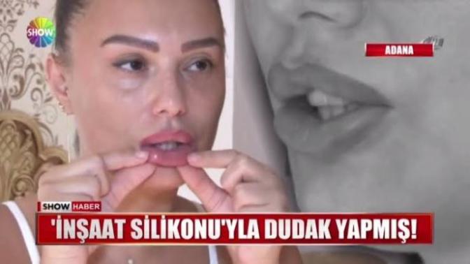 Bu ara kadinlarda manda dudaği modasi mi var? Silikonu sıktıran orangutan gibi geziyor yahu. Fazla kalin dudak çekici mi sizce?
