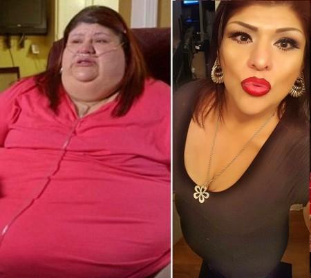İleride eşiniz obez veya morbid obez olursa ondan ayrılır mısınız destek mi olursunuz?