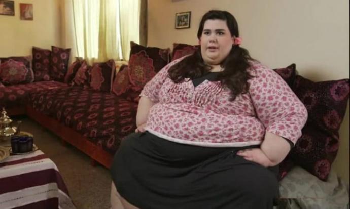 İleride eşiniz obez veya morbid obez olursa ondan ayrılır mısınız destek mi olursunuz?