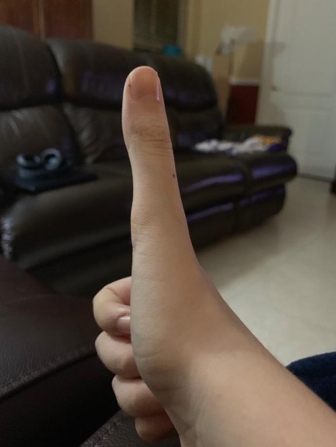 Parmağım çok mu uzun?