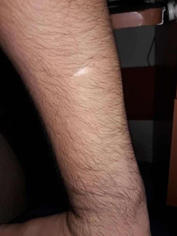 Polis olmama engel olur mu?