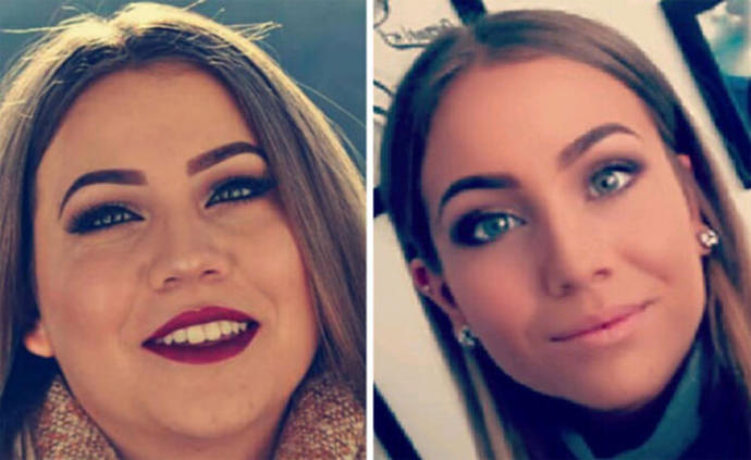 Zayıflayınca burun küçülür mü, büyür mü? Kilo verince burun değişir mi?