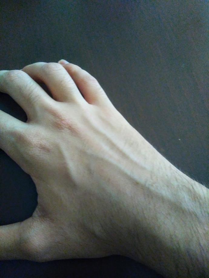 Kızlar eldeki damarlar itici mi sizce?