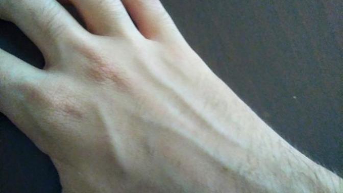 Kızlar eldeki damarlar itici mi sizce?