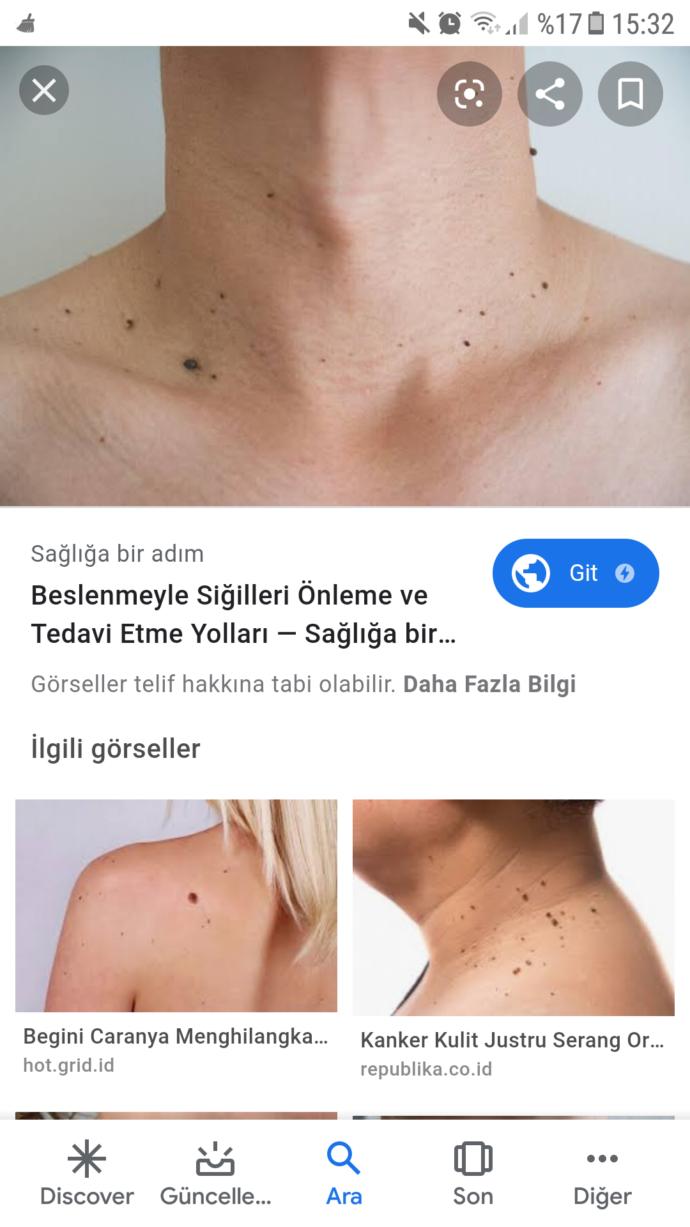 bunun gibi