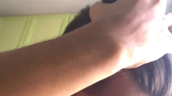 Hair line ım çok gerde?