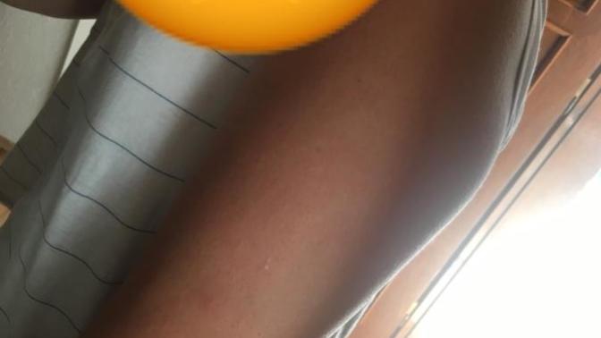 Kollarım çok kalın ve yağlı, ne yapabilirim?