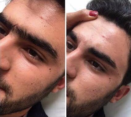 Sizce erkekler kaşlarını almalı mı? Erkekler, kaşlarınızı alıyor musunuz?