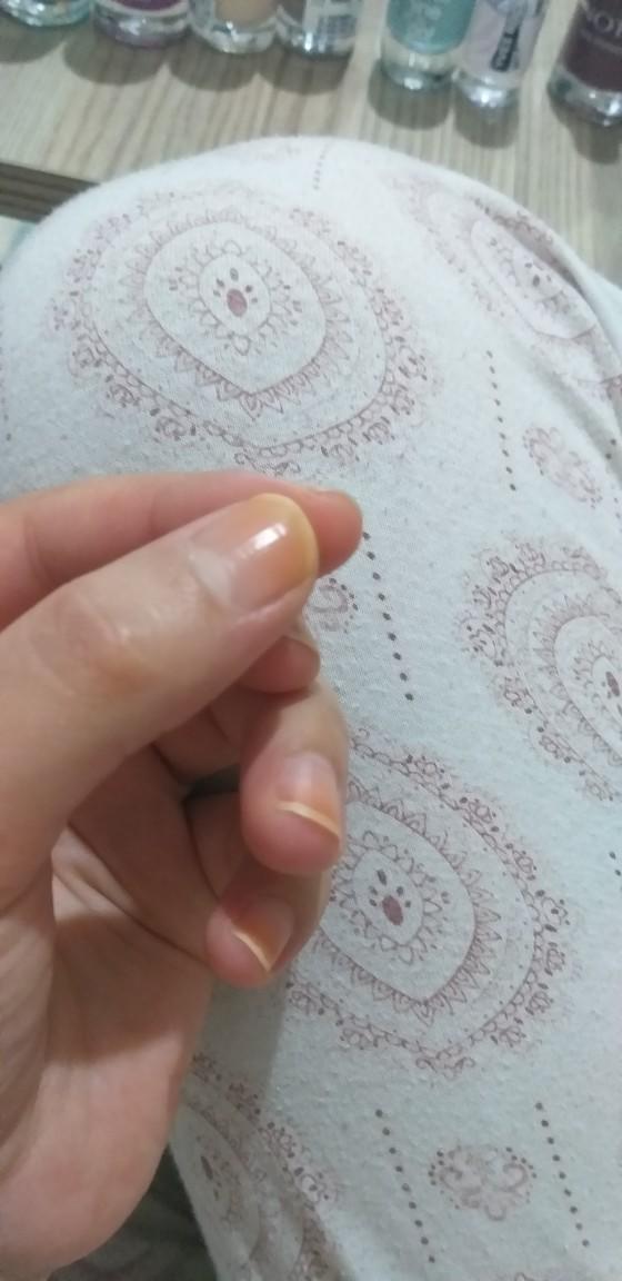 Tırnak kırılmasına nasıl çözüm bulabilirim :( ?