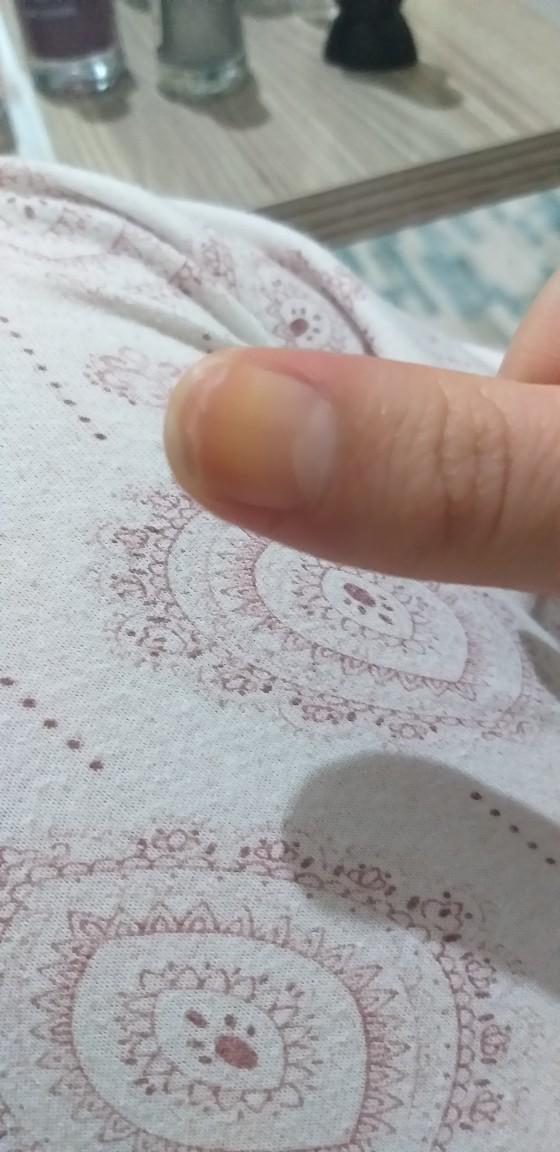 Tırnak kırılmasına nasıl çözüm bulabilirim :( ?
