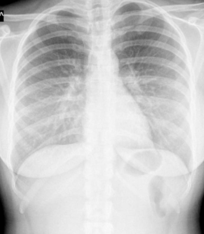 Belki içinizde doktor vardır. ne diyor bu grafi?