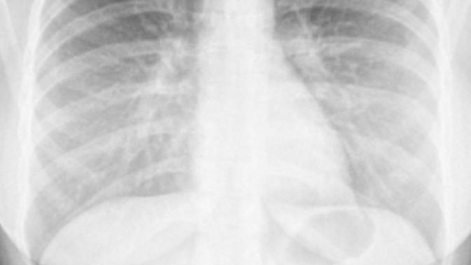 Belki içinizde doktor vardır. ne diyor bu grafi?