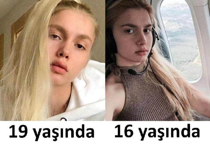Aleyna Tilki estetiğin sınırlarını aştı mı sizce?