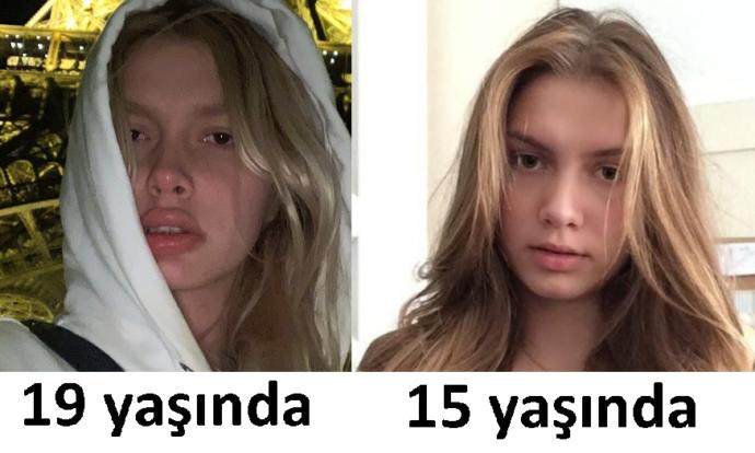 Aleyna Tilki estetiğin sınırlarını aştı mı sizce?